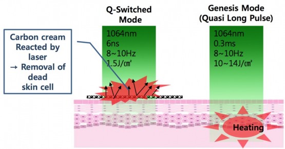 PASTELLE - Q-Switched laser solution for pigment &amp; tattoo ...